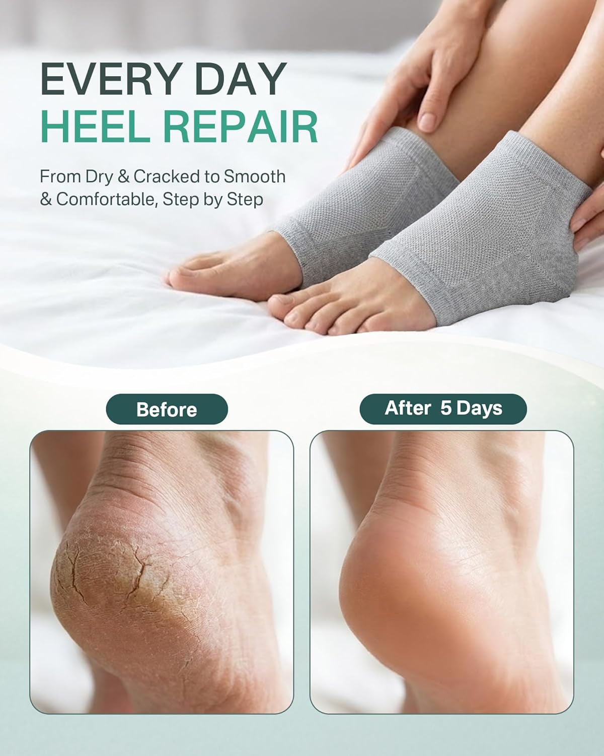 Moisturizing Silicone Socks for Dry Cracked Heels, 2 Pairs
