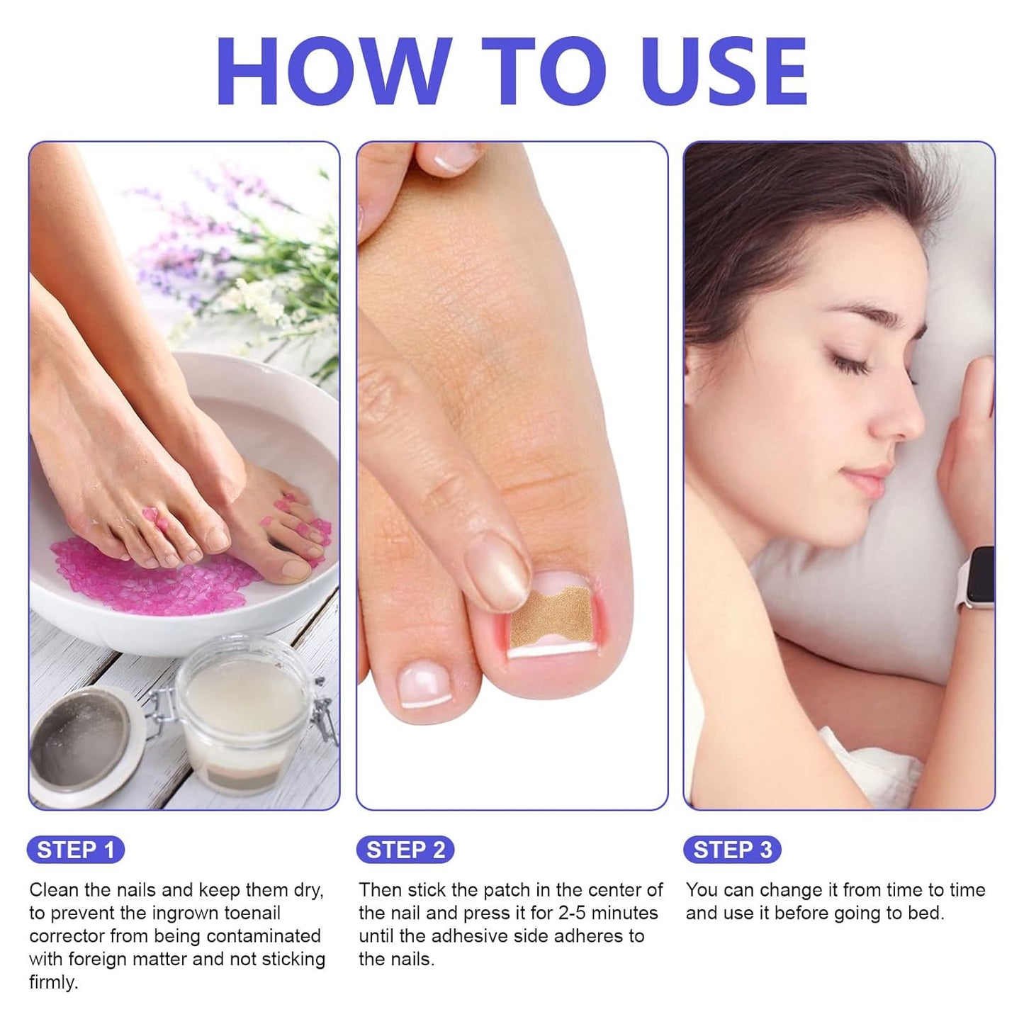 Ingrown Toenail Corrector Patches, 100Pcs