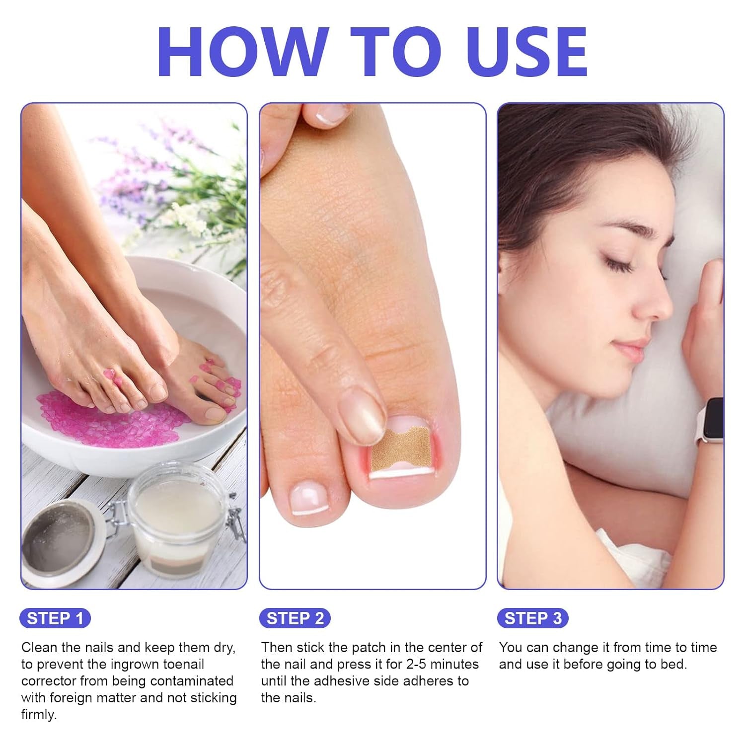 Ingrown Toenail Corrector Patches, 100Pcs